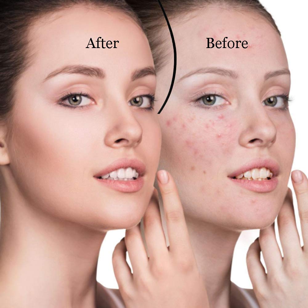 Vacuum Face Skin Care Vacuum Face Skin Care